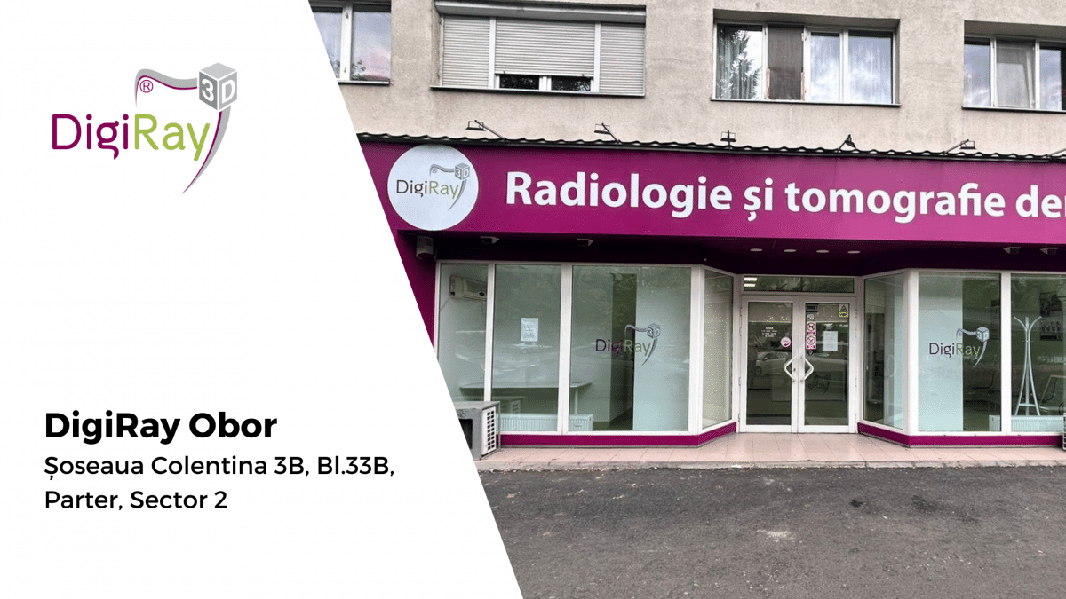 Radiografie dentară Obor