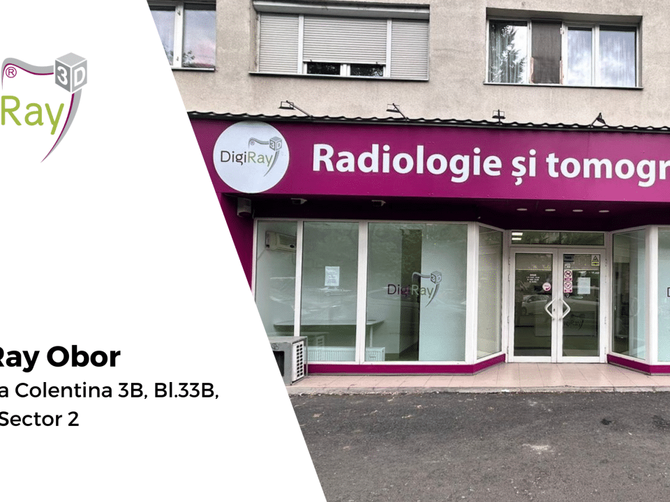 Radiografie dentară Obor