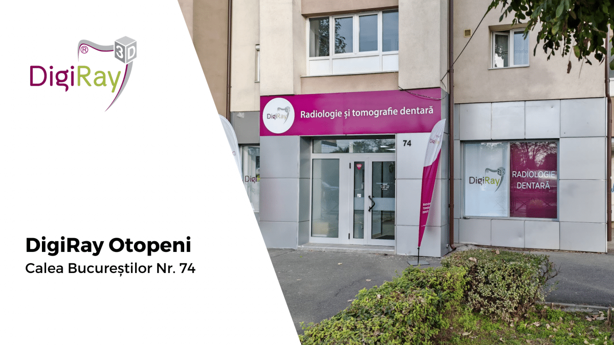 radiografie dentară Otopeni