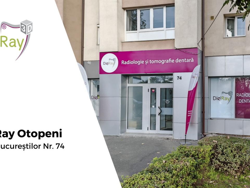 radiografie dentară Otopeni